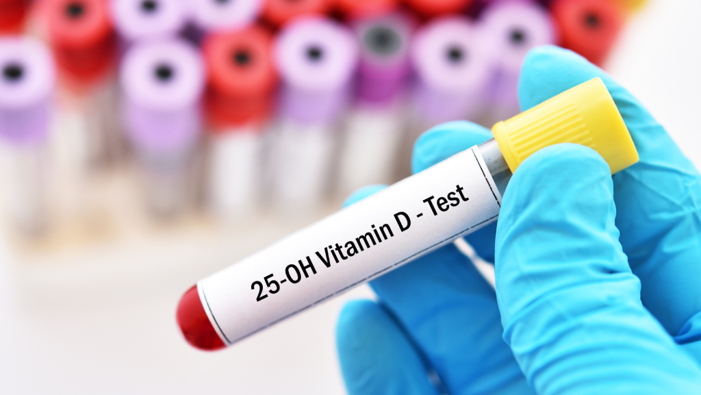 Zu sehen ist eine Blutprobe auf der Vitamin D-Test steht