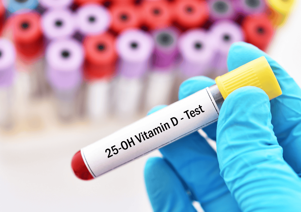 Zu sehen ist ein Röhrchen der Blutabnahme, was symbolisch für Blutwerte von Vitamin D steht, um die es in der Tabelle "Serumwerte von Vitamin D in der Zahnmedizin" geht.